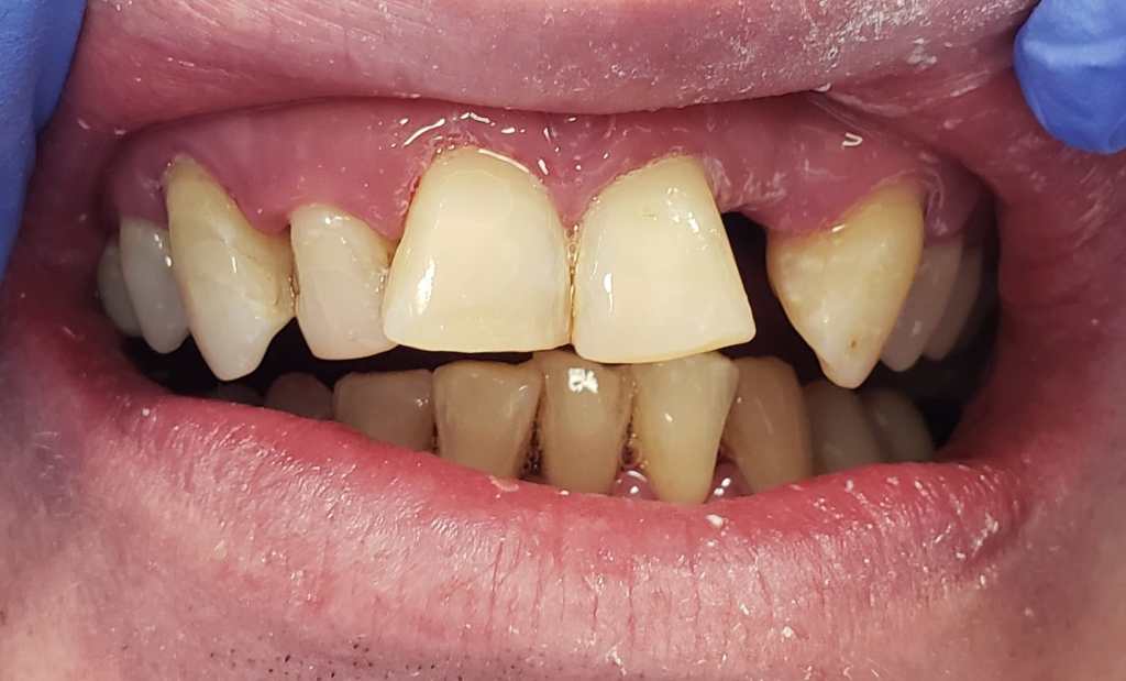 after Cleaning and Polishing